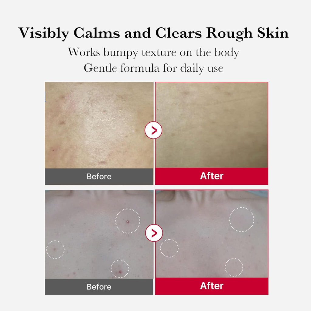 Medicube Red Body Peeling Shot