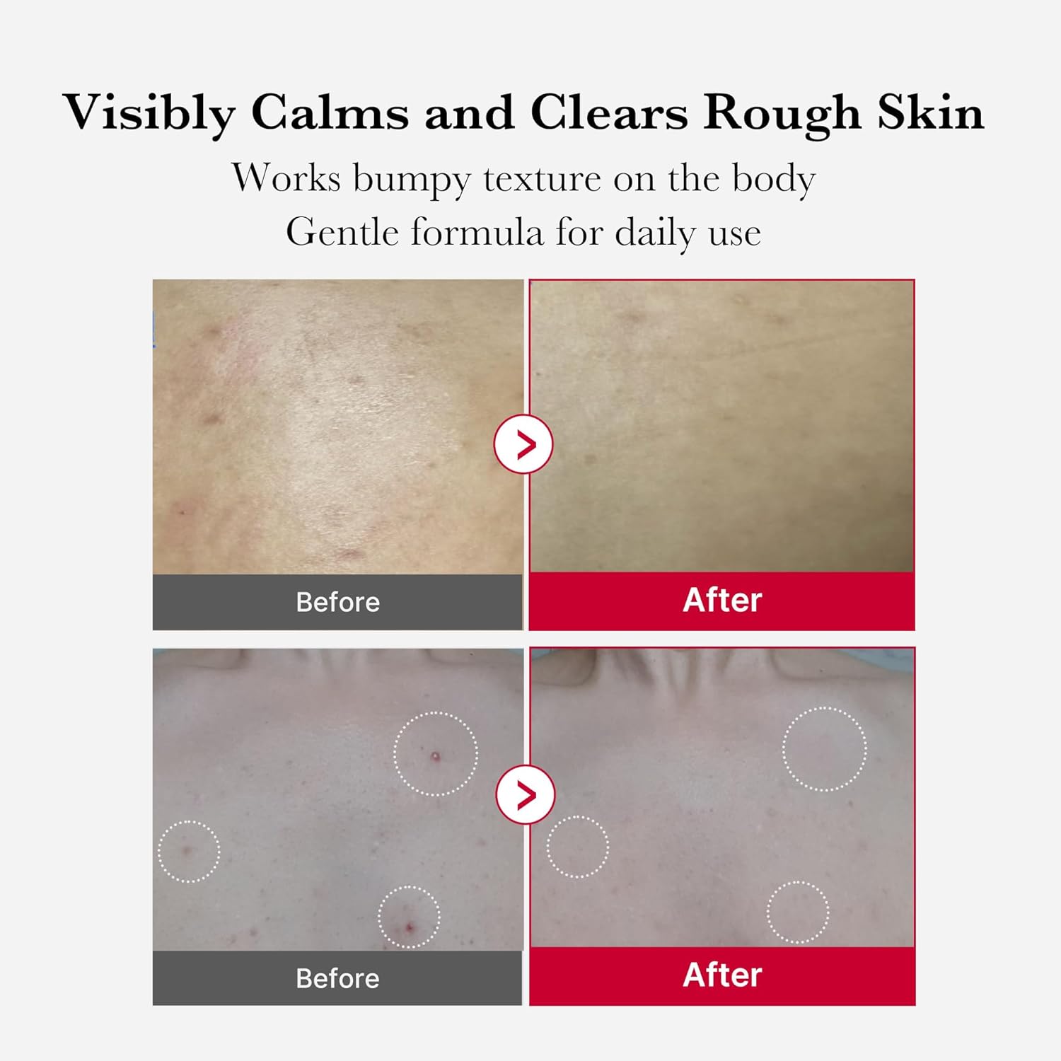 Medicube Red Body Peeling Shot