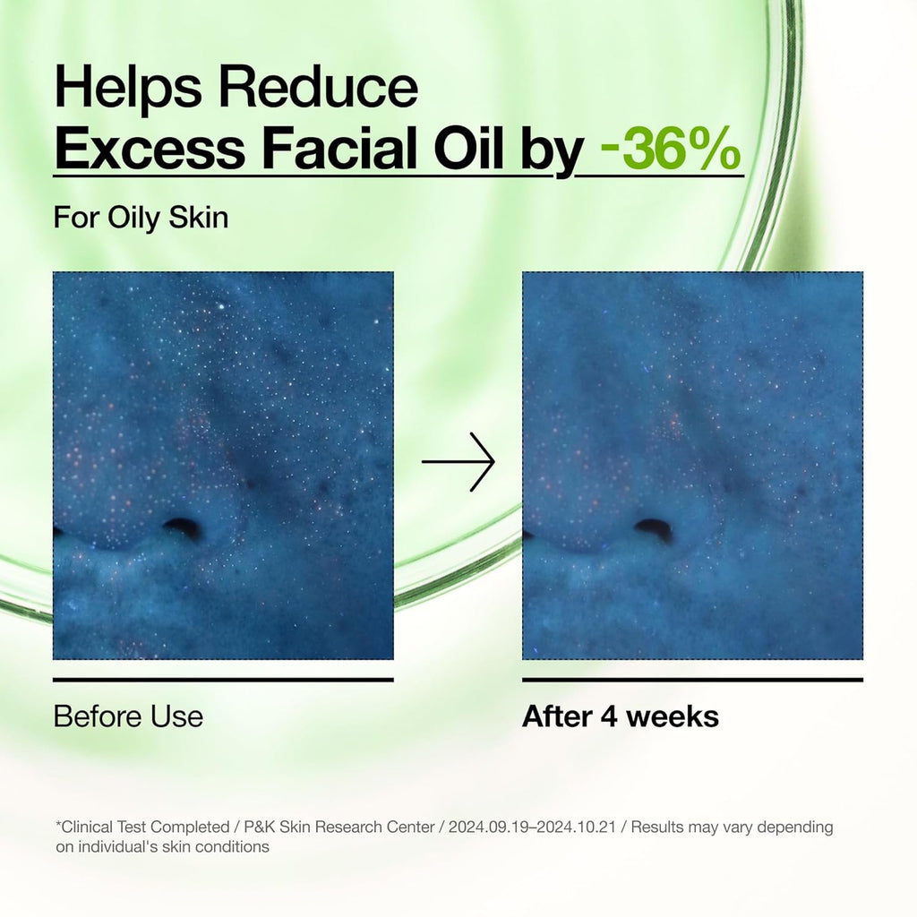 ANUA 10+AZELAIC ACID HYALURON REDNESS SOOTHING SERUM