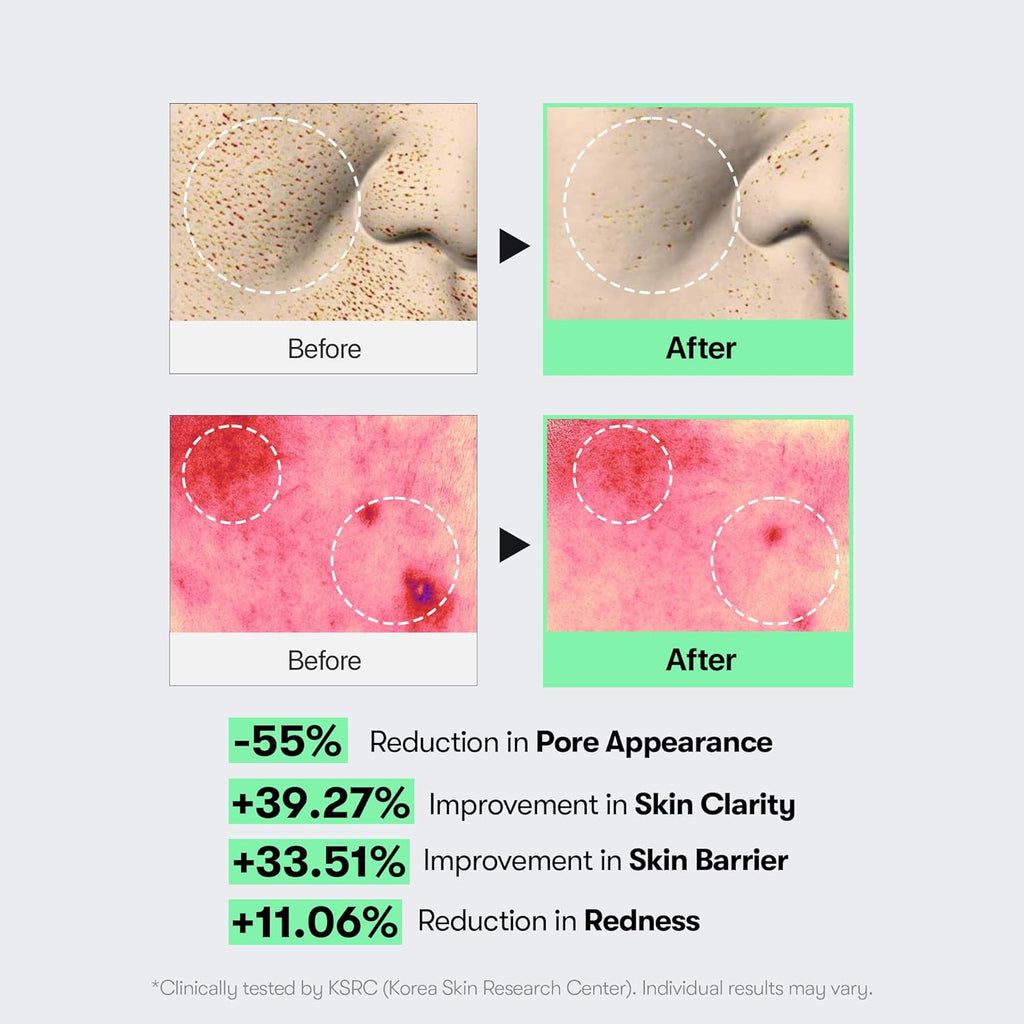 VT COSMETICS REEDLE SHOT 100 CICA REEDLE