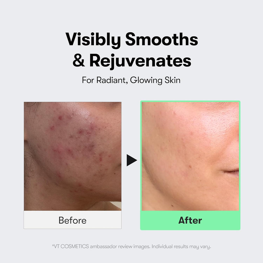 VT COSMETICS REEDLE SHOT 100 CICA REEDLE