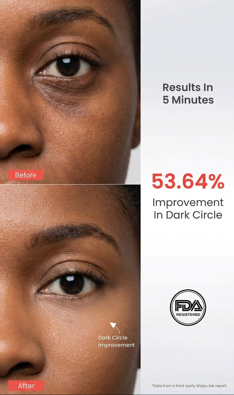 AMIRO EyeGlow Red Light & Microcurrent Eye Cream