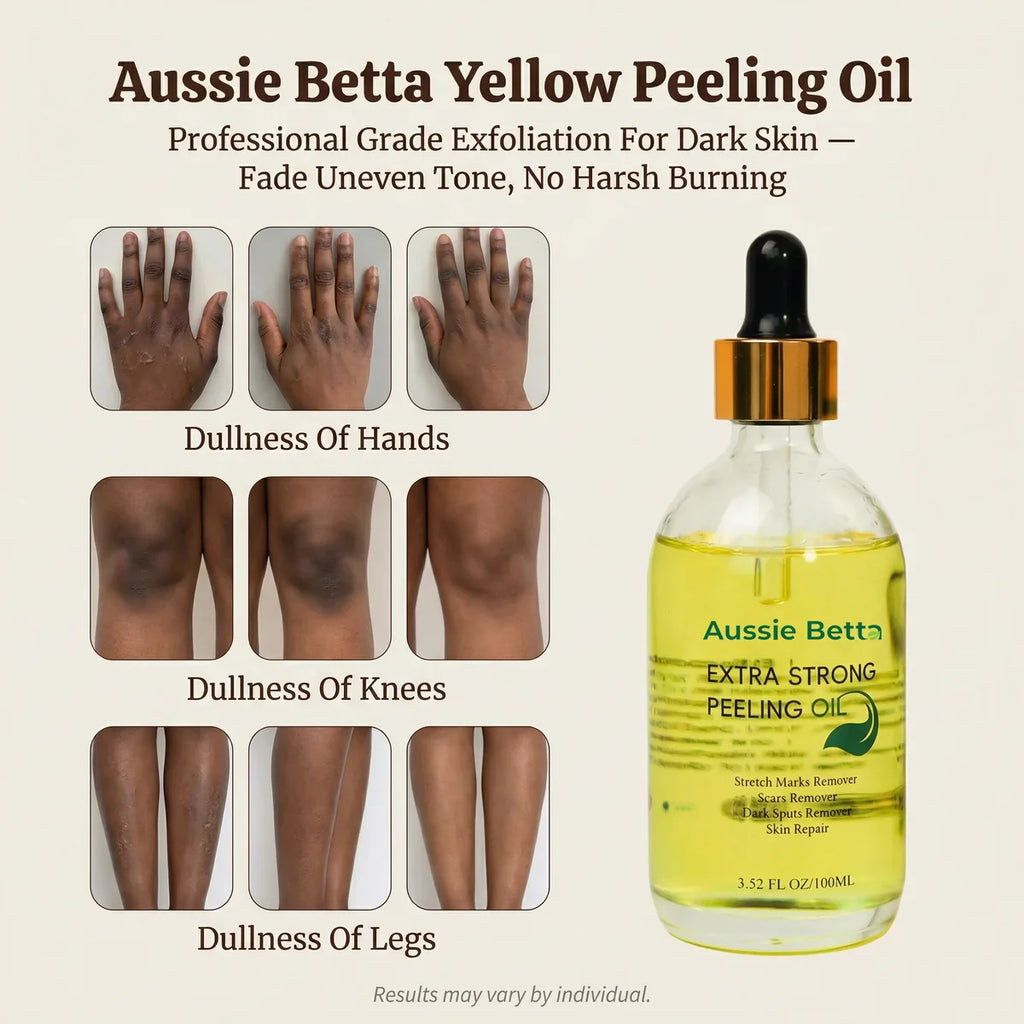 Aussie Betta peeling oil
