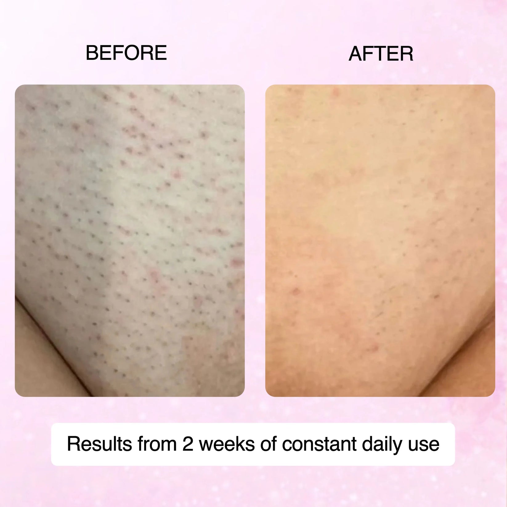 Cyperus Rotundus Hair Removal Oil