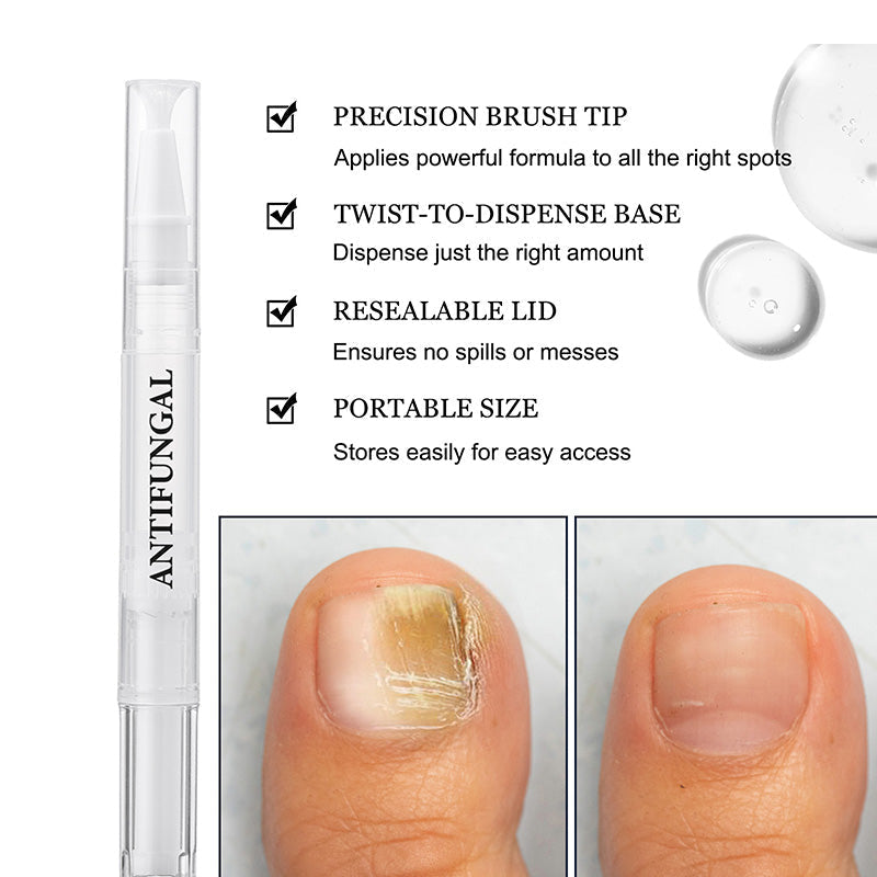 Stylo réparateur pour ongles